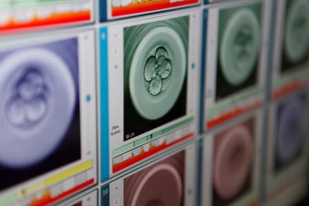 Dexeus Mujer et l'IDIBELL étudieront le développement embryonnaire grâce à l'édition génomique d'embryons humains