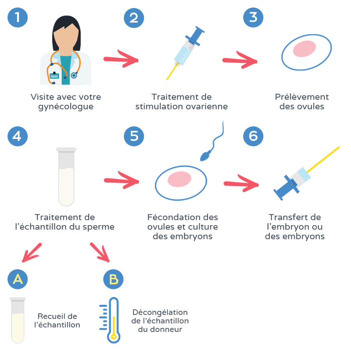 Fécondation in vitro - Processus