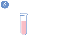 Don d’ovocytes - Traitement de l’échantillon du sperme
