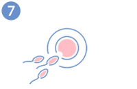 Don d’ovocytes - Fécondation de l’ovule et culture des embryons