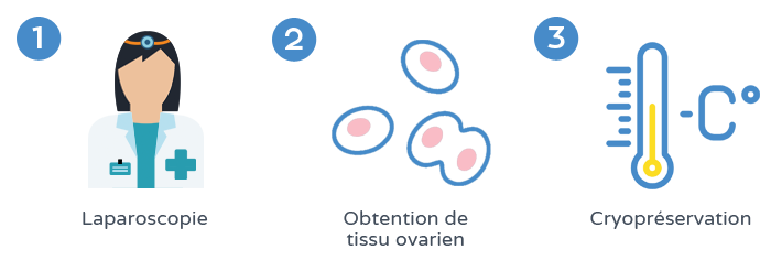 Préservation de la fertilité - Cryopréservation du tissu ovarien